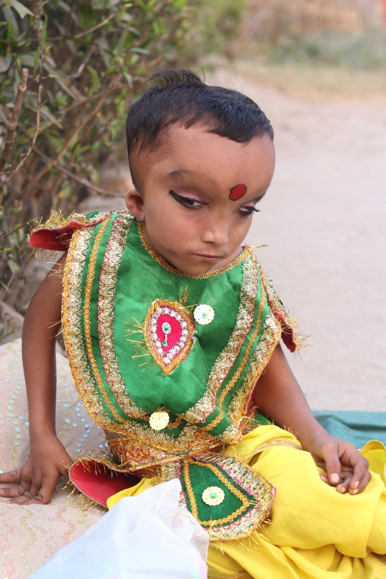 Menino com condição médica desconhecida é adorado como deus hindu na Índia