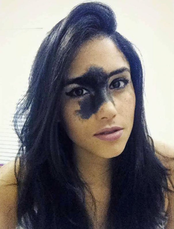 A brasileira que ficou mundialmente famosa por causa de marca de nascença