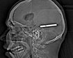 thumb-image-2024-02-29T13:58:43.473Z