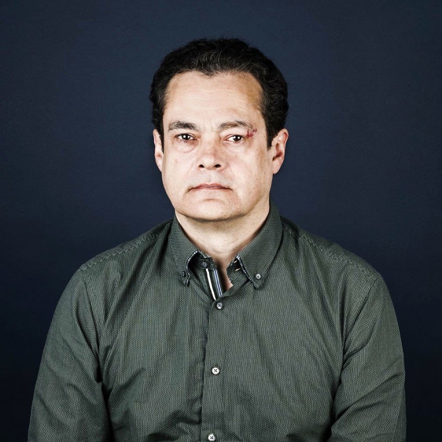 Este ensaio com pessoas que têm marcas de nascença vai mexer com você