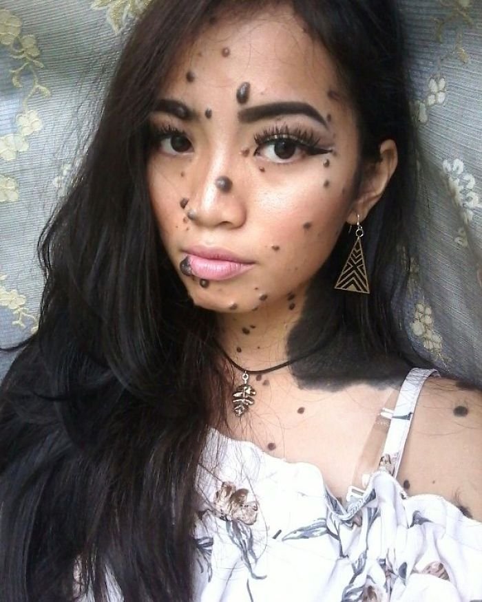 Jovem que sofreu bullying por causa de sua aparência quer ser Miss Universo