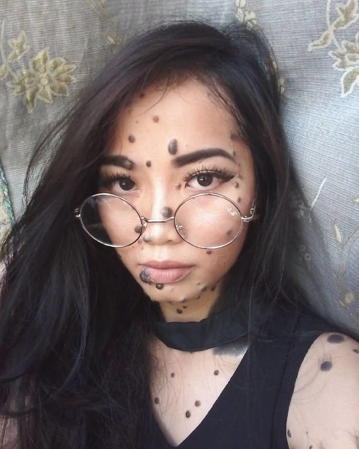 Jovem que sofreu bullying por causa de sua aparência quer ser Miss Universo