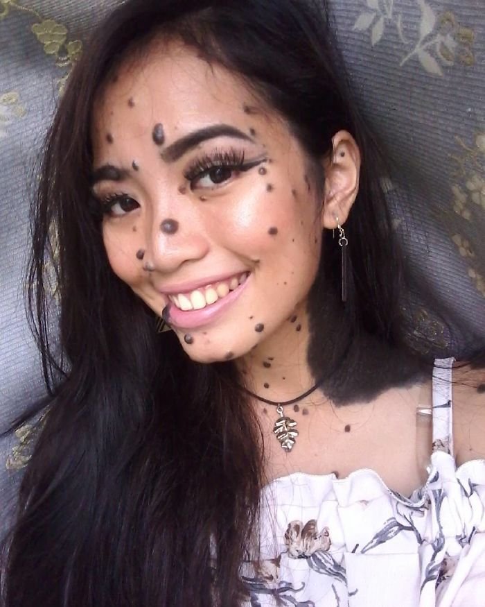 Jovem que sofreu bullying por causa de sua aparência quer ser Miss Universo