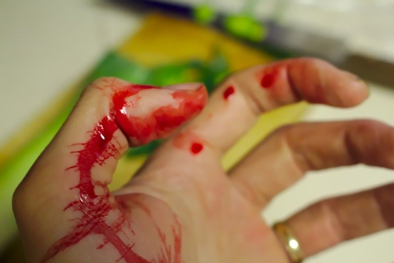 Pessoa com ferimento na mão