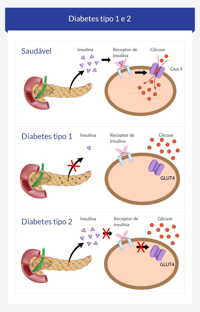Tipos de diabetes