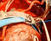thumb-image-2024-02-29T14:02:51.010Z