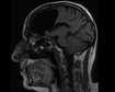 thumb-image-2024-02-29T14:03:09.161Z