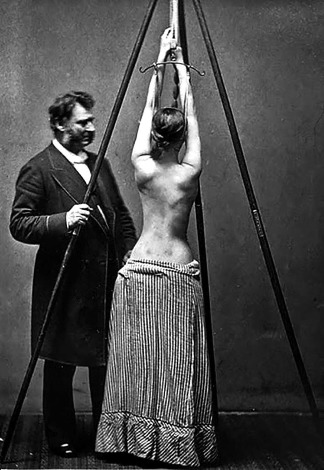 Imagens bizarras retratam tratamentos médicos ao longo da história