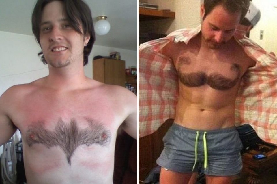 Primeiros socorros para pé inflamado