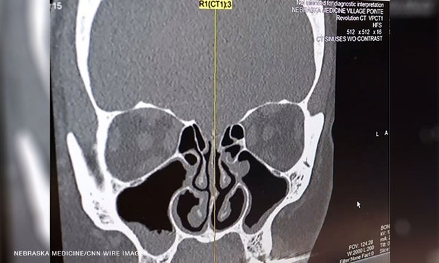 Radiografia de crânio