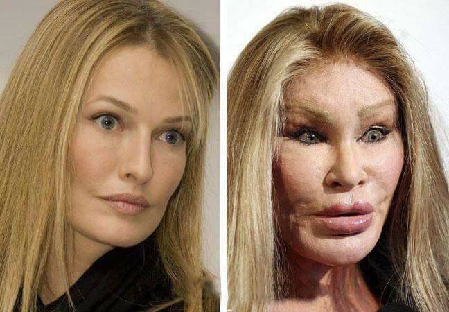 Antes e depois das cirurgias plásticas