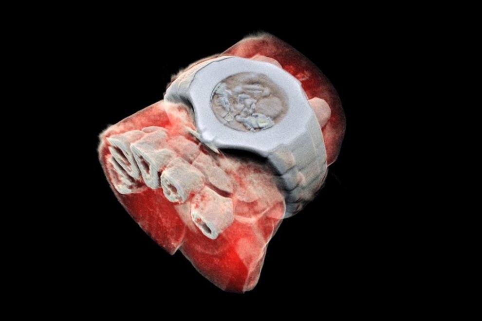Imagem de Inventaram uma engenhoca que captura raios X 3D coloridos do corpo humano no megacurioso