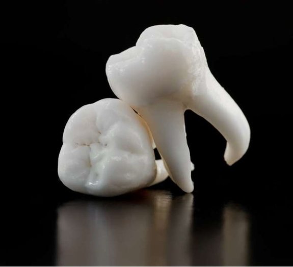 7 curiosidades sobre o dente do siso