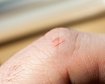thumb-image-2024-02-29T14:03:45.625Z
