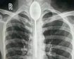 thumb-image-2024-02-29T14:03:48.301Z