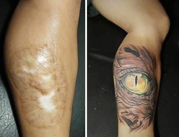 Cicatriz que virou tattoo