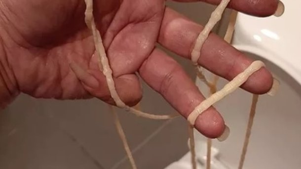 https://hojees.com.br/homem-tira-tenia-de-10-metros-do-proprio-anus-ao-ir-ao-banheiro/