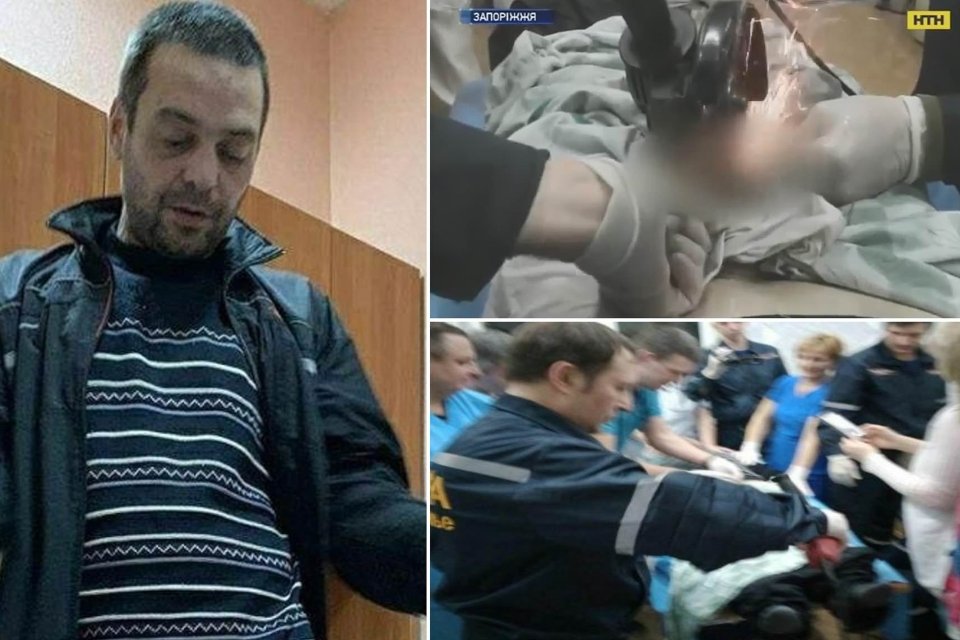 Imagem de Cinto de castidade faz homem parar no hospital no megacurioso
