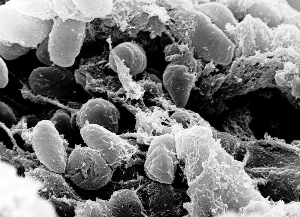 Imagem microscópica da bactéria Yersinia pestis. (Fonte: Wikimedia Commons/Reprodução)