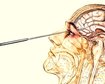 thumb-image-2024-02-29T14:04:44.450Z
