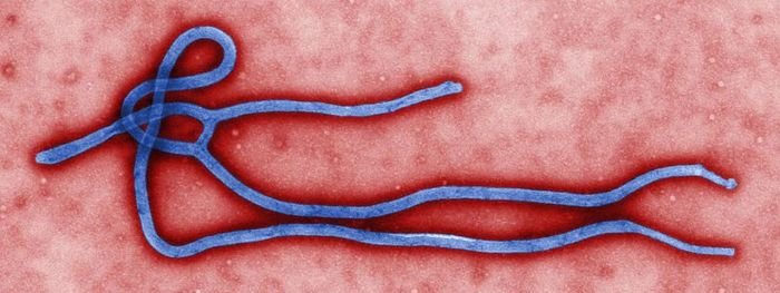 O vírus Ebola foi descoberto em 1976, na região entre o Congo e o Sudão.