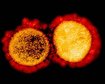 thumb-image-2024-02-29T14:04:47.347Z