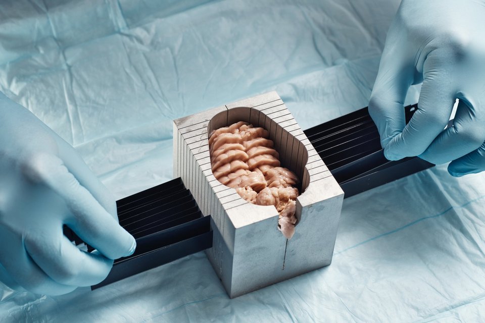 Imagem de Cientistas reativam células cerebrais de porcos mortos no megacurioso