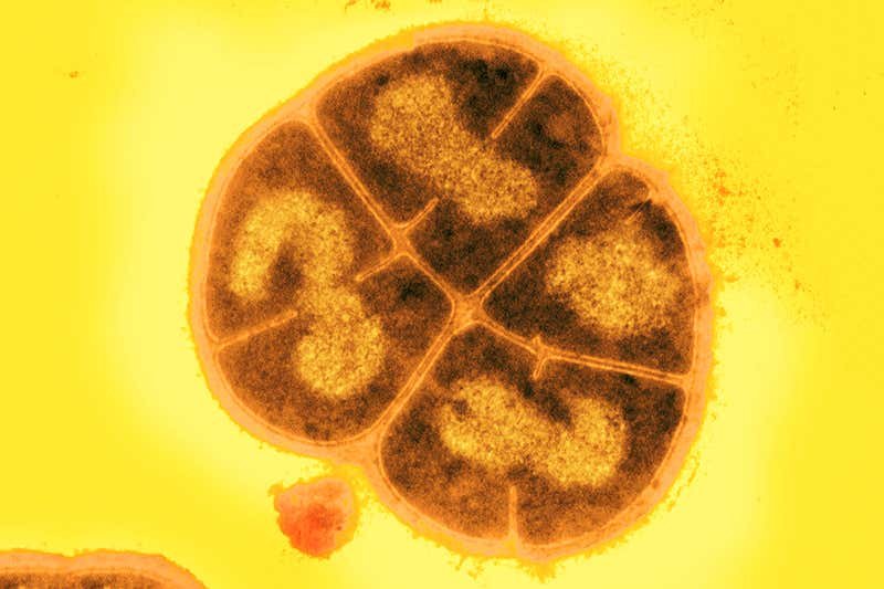Deinococcus radiodurans (Fonte: Michael J Daly/Science Photo Library - Reprodução)