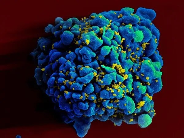 Uma célula T azul e verde, infectada pelo HIV em amarelo (Fonte: NIAID/Reprodução)