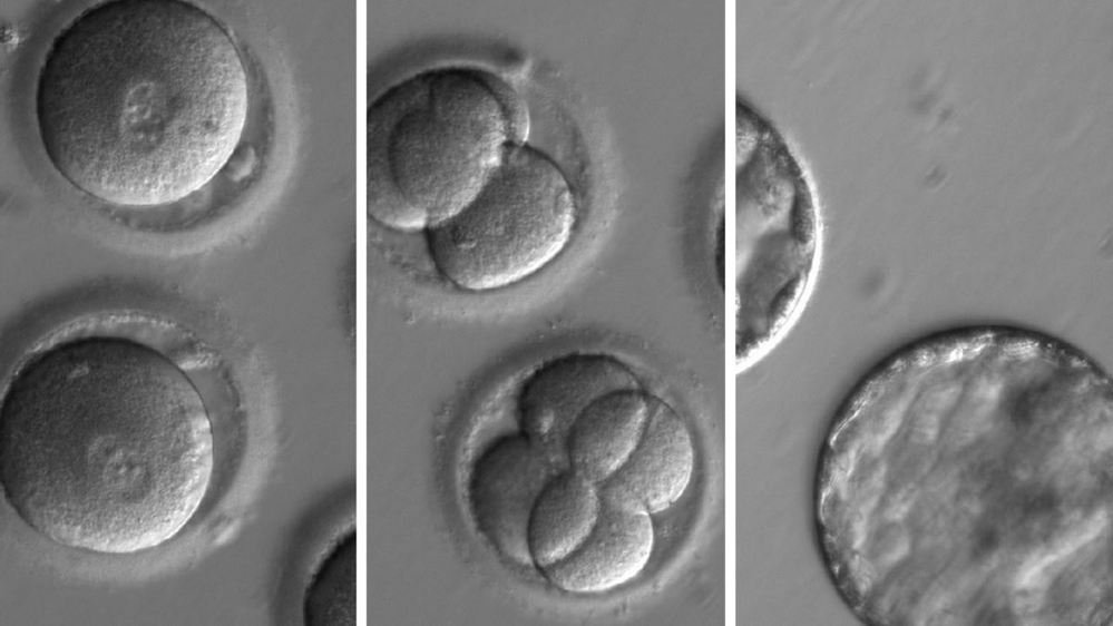 A sequência de imagens mostra o desenvolvimento de embriões cujos genes foram editados nos EUA.