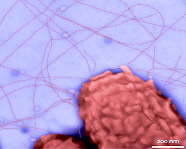 As bactérias e seus nanofios (Fonte: LiveScience/Reprodução)