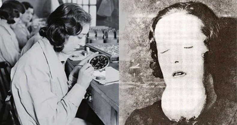 Conhecidas como Garotas do Radium, as pintoras das fábricas sofreram com as sérias consequências do envenenamento por radiação.(Fonte: Pinterest/Reprodução)