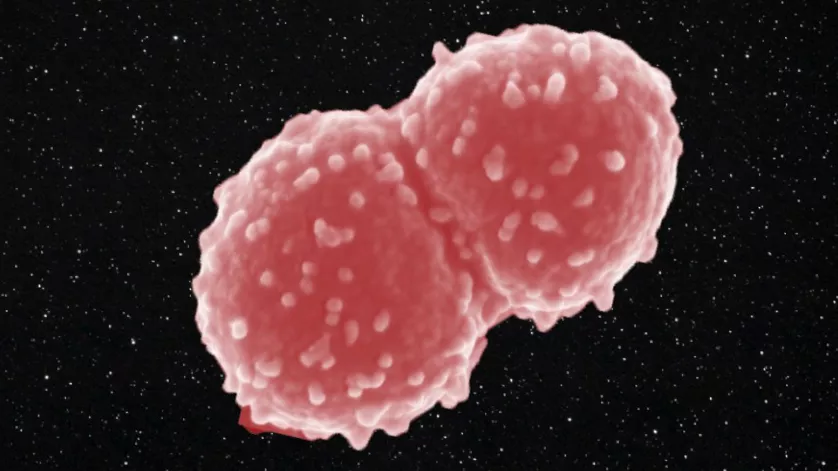 Deinococcus radiodurans sobreviveu a um ano no espaço