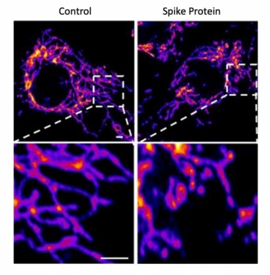 Proteína spike fragmentando as mitocôndrias ao se ligar ao ACE2. (Fonte: Salk Institute)