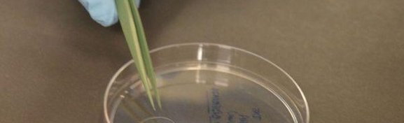 Imagem de Candida auris: o superfungo resistente a medicações no megacurioso