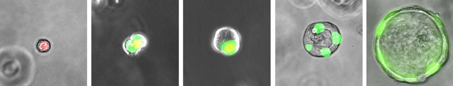 As células RAS podem se transformar em células AT2, que "curam" alvéolos doentes (Imagem: Universidade da Pensilvânia/Reprodução)