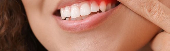 Imagem de Por que os seres humanos têm dentes caninos? no megacurioso