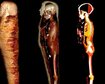 thumb-image-2024-02-29T14:06:40.128Z