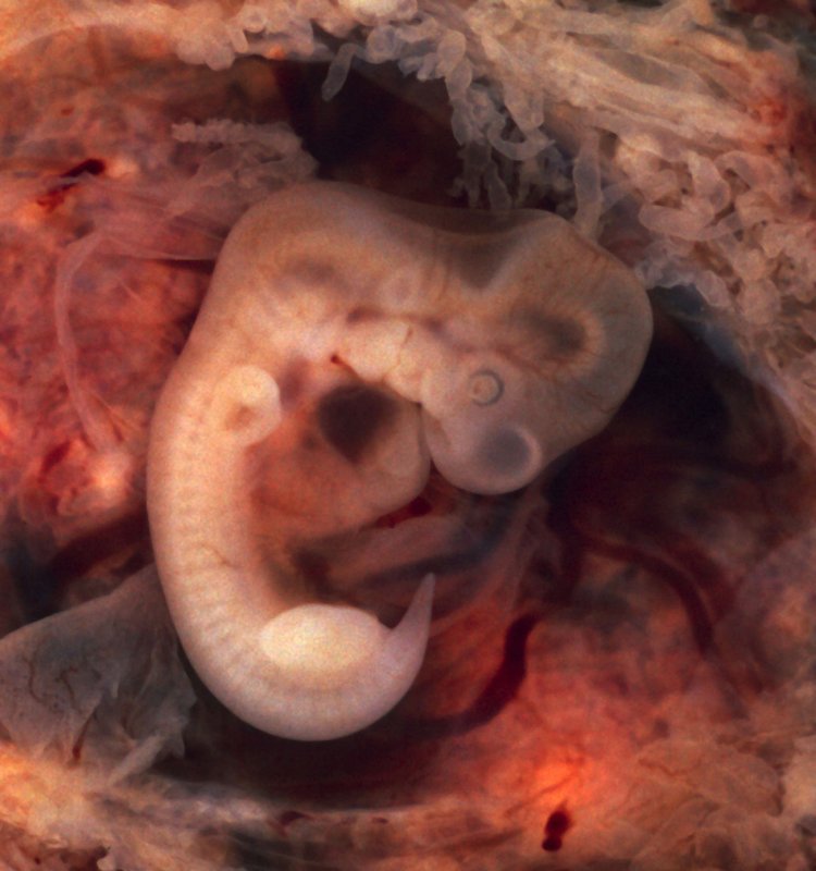 Embrião humano. (Fonte: Wikimedia Commons)