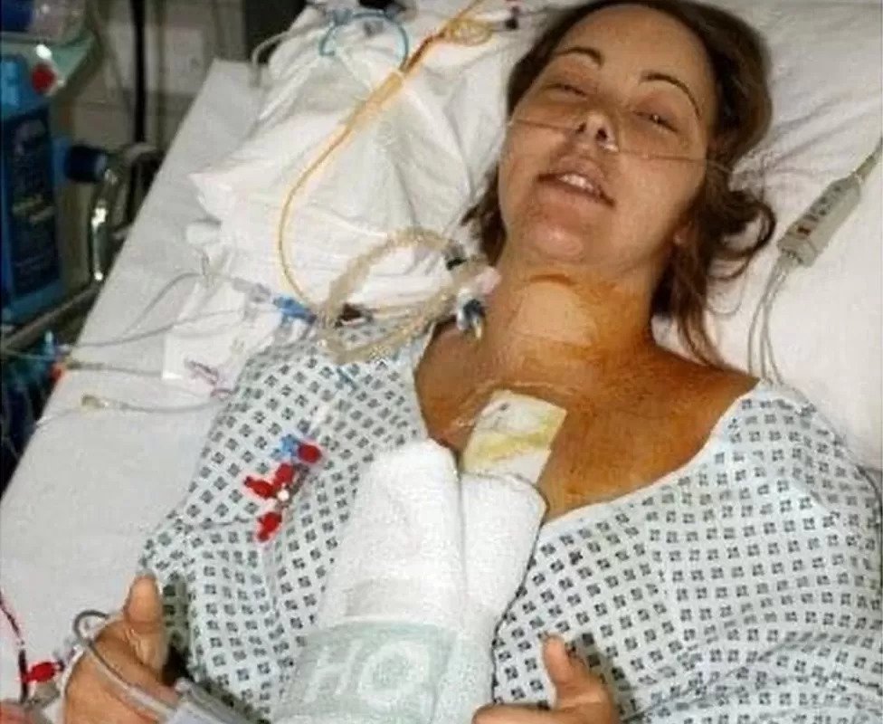 Jennifer acordando após a cirurgia de coração realizada em 2007. (Fonte: BBC/Reprodução)