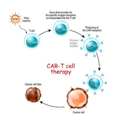 O tratamento CAR-T utiliza células do sistema imunológico do próprio paciente.