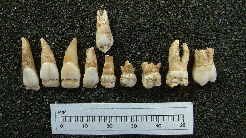 Estudo dos dentes mostrou sinais de desnutrição. (Fonte: John Buglass Archeology/Durham University/Reprodução)