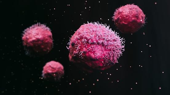 Novo método de escaneamento pode facilitar a identificação de tumores em estágios iniciais. (Fonte: Getty Images/Reprodução)