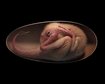thumb-image-2024-02-29T14:07:04.774Z