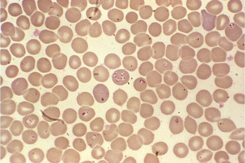 A babesiose é causada por protozoários e caracterizada pelo ataque aos glóbulos vermelhos do sangue (Fonte: Wikimedia Commons/Reprodução)