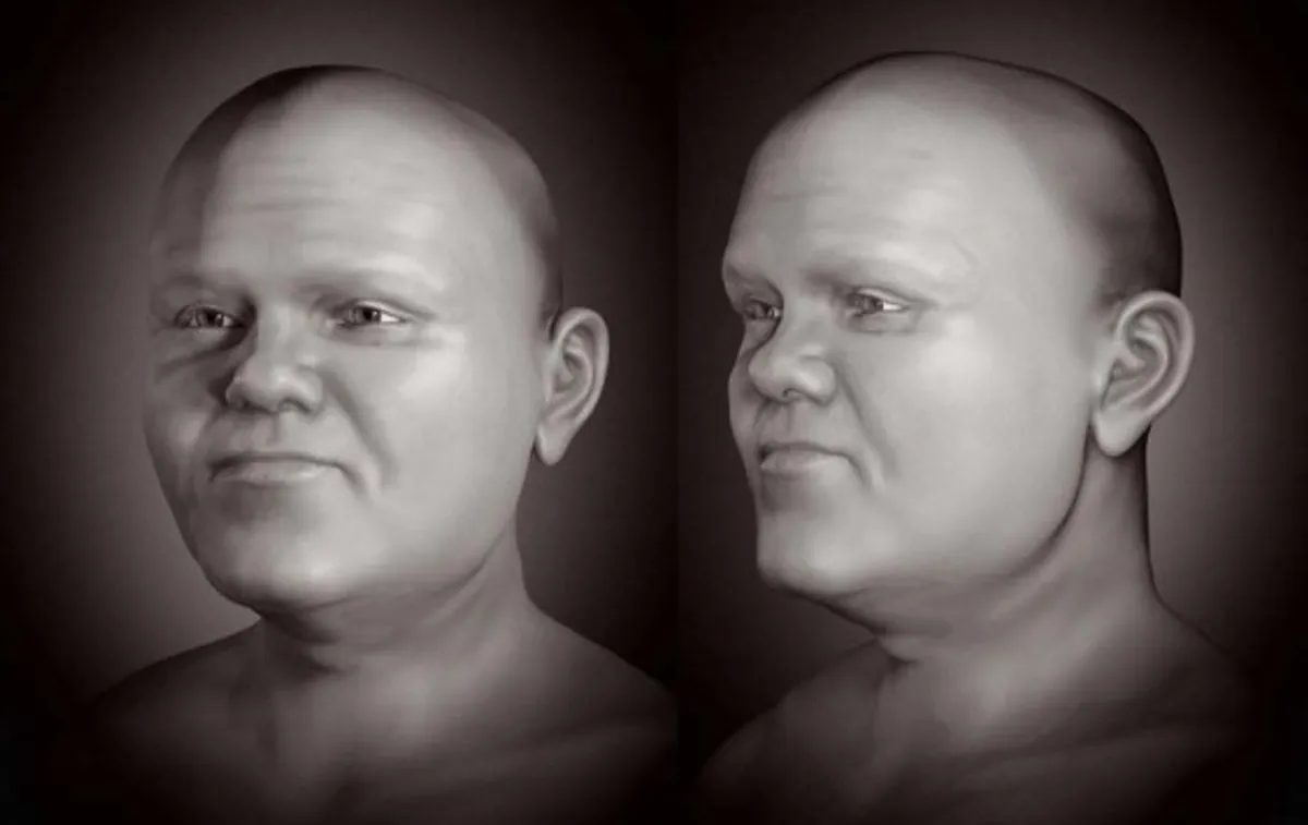 Imagem da reconstrução facial de um homem com acondroplasia. (Fonte: IFLScience/Reprodução)