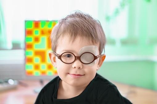 Uso de óculos e tapão pode ajudar no tratamento do estrabismo.