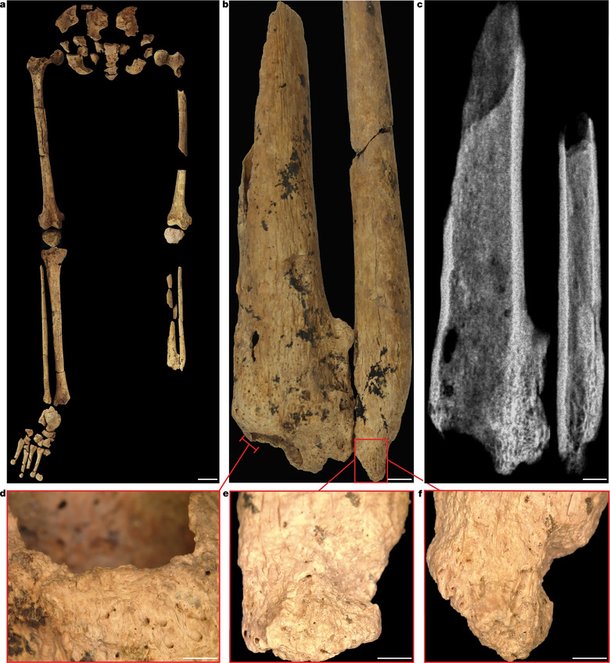 Cientistas encontram osso com sinal de cicatrização após amputação. (Fonte: T. Maloney et al - Nature / Divulgação)