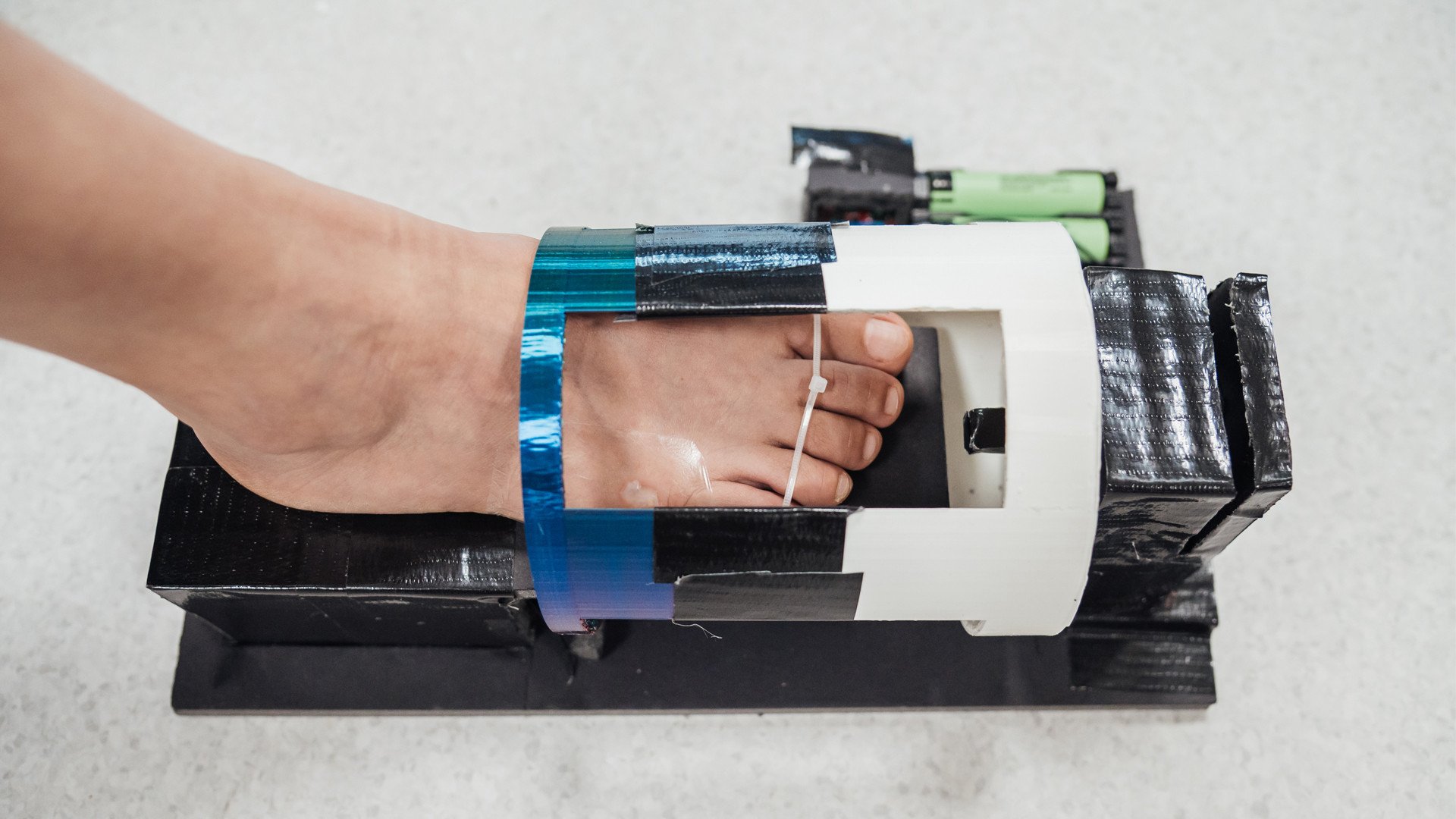 O curativo com hidrogel magnético é colocado sobre a ferida e um dispositivo externo é utilizado para acelerar o processo de cicatrização. (Fonte: NUS/Reprodução)