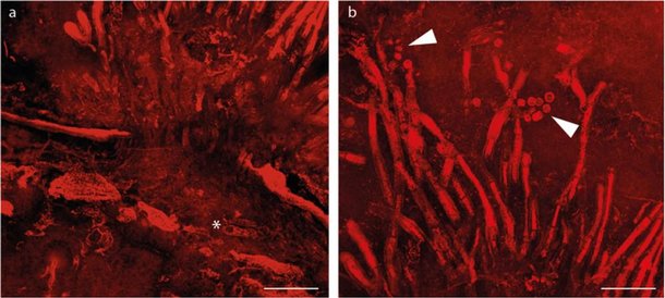 Imagens de microscpio mostram momento em que o fungo comeou a atacar a planta. (Fonte: Live Science/Reproduo)